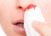 Причины крови из носа