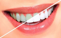 Цели и методы эстетической стоматологии